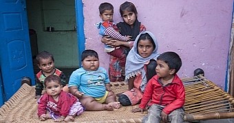 Baby girl in India weighs as much as a 6-year-old