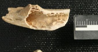 Evidence of bone tumor discovered in 120,000-year-old Nenderthal rib (click to see full image)