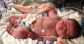 14-Pound (6.4-Kg) Baby Born in Utah Has Diabetes