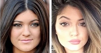 Kylie Jenner swears her look is 100% natural, what do you think?