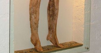 Pants on display at museum in Iceland are made from human legs