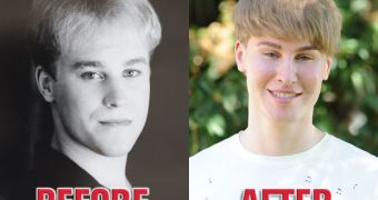 Toby Sheldon before and after getting plastic surgery to look like Justin Bieber