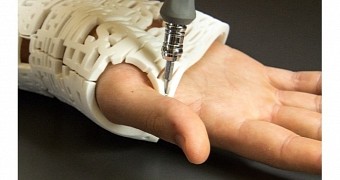3D Printed Casts Heal Your Bones, Accept Twitter and Facebook Signatures – Video