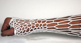 Researchers develop 3D printed cast