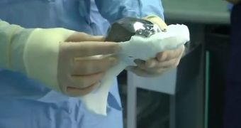 3D Printed Hip Implant Saves Woman from Pain and Disfigurement – Video