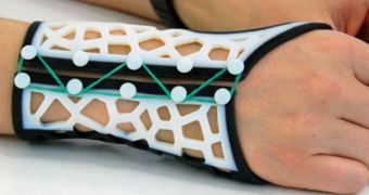 3D printed splint