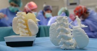 3D printing help remove inoperable tumor