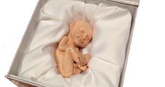 The 3D printout of the fetus comes in a special wooden box