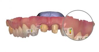 3Shape's dental expertise now available to 3D Systems