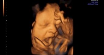 4D scans performed by Durham University researchers reveal footage of a yawning fetus