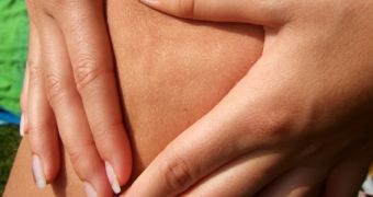 Up to 95 percent of all women have cellulite, report says