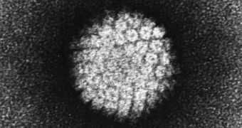 This is a TEM image of the HPV virus