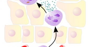 Immune system cells known as neutrophils play an important role in inflammatory diseases