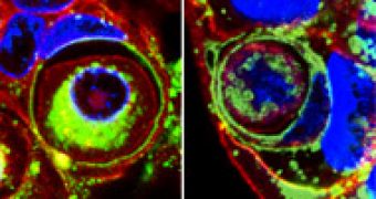 A tumor cell (left) and a normal breast cell (right) inside other cells (green rings)