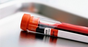 Researchers say something as simple as a blood test could one day serve to diagnose cancer