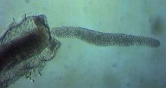 Buddenbrockia exiting from a bryozoa (a sea animal)