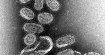 This negative stained transmission electron micrograph (TEM) shows recreated 1918 influenza virions