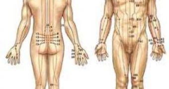 Acupuncture Added to Routine Care Eases Osteoarthritis Pain and Symptoms
