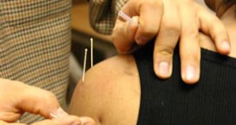 Acupuncture cannot, apparently, alleviate the symptoms of hot flushes