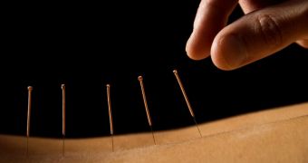Reseachers say that acupuncture can help menopausal women experience less intense and less frequent hot flashes