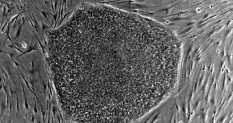 UCB experts develop a way of creating progenitor muscle stem cells from adult muscle cells