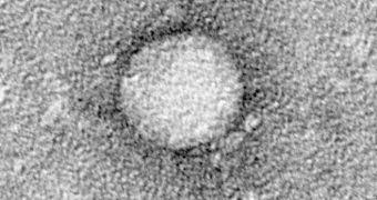 This is the HCV virus, which causes hepatitis C