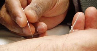 Acupuncture is one of the most appreciated forms of CAM therapies