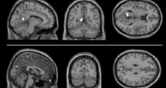 FMRI studies can reveal the risk a person has of developing Alzheimer's