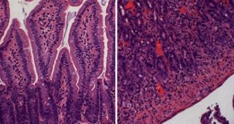 The image at left shows tissue from the intestine of a normal mouse. At right, in a mouse infected with Toxoplasma gondii, the intestines are inflamed and have lost much of their normal structure