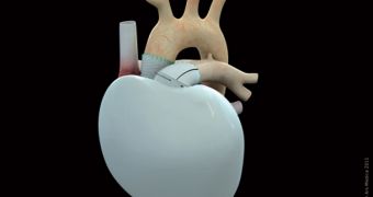 An image of the new artificial heart developed in Europe