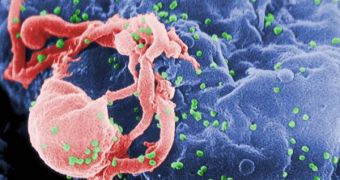 Scanning electron micrograph of HIV-1 budding from cultured lymphocyte