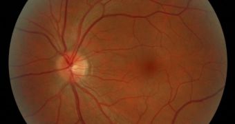 A photograph of a human retina