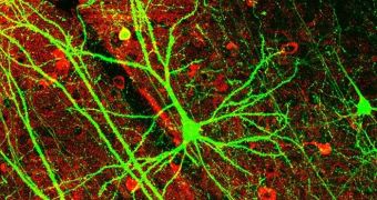 The BRAIN Initiative will first focus on reversing memory loss and understanding brain circuitry