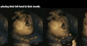 4D scans show babies learn to anticipate touch while still in the womb