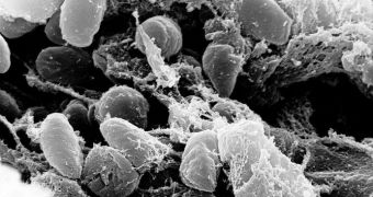 Scanning electron micrograph depicting a mass of Yersinia pestis bacteria in the foregut of the flea vector