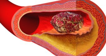 Blood clots can trap bacterial toxins, preventing septic shock in humans