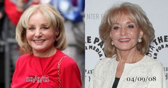 Barbara Walters, before and after a rumored surgical intervention