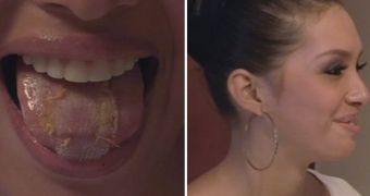 A Miss Venezuela contestant sews a plastic patch on her tongue to make eating solids impossible, in an effort to lose weight faster