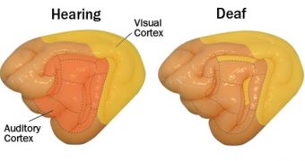 In hearing cats (left), visual cues are processed in one place (yellow) and sound data in another (orange), but in deaf cats, parts of the auditory regions become visual (small yellow areas)