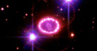 The brightest supernova in the last 400 years, SN 1987A