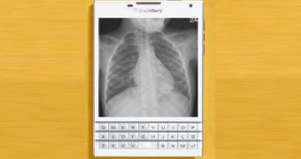 An x-ray of a lung displayed on BlackBerry Passport