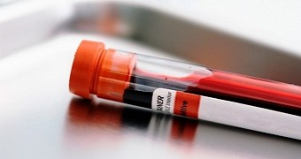 Blood Test Diagnoses Depression, Predicts Response to Therapy