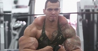 Romario Dos Santos Alves wanted to look like The Hulk, ended up like this