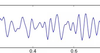 An EEG showing beta wave activity