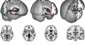 Brain Size and Video-Game Performance Are Related