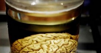 The thief stole human brain tissue and sold it on eBay