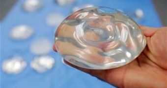 UK hotel chain releases list of lost and found in 2012, pair of breast implants is on it