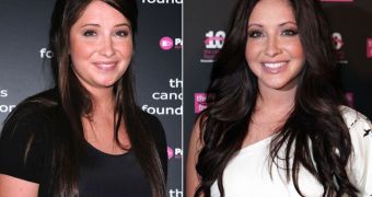 Bristol Palin before and after, thanks to “corrective jaw surgery”