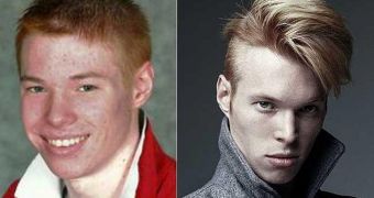 Louis Evans had a difficult adolescence because of his red hair