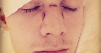 Barron Hilton is looking to get surgery after he's been battered during party altercation